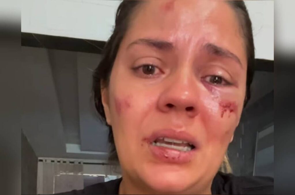 imagem colorida mulher relata acidente em parque aquatico
