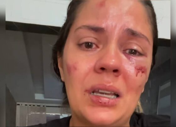 imagem colorida mulher relata acidente em parque aquatico