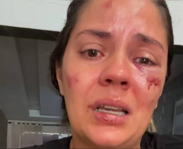 imagem colorida mulher relata acidente em parque aquatico